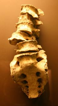 Free Stock Photo of Spinal column
