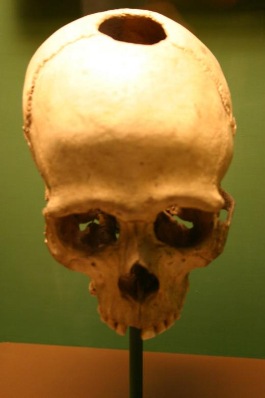 Free stock image of Skull created by Bjorgvin