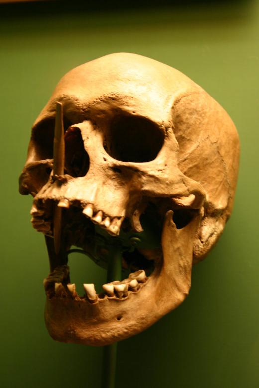 Free stock image of Skull created by Bjorgvin
