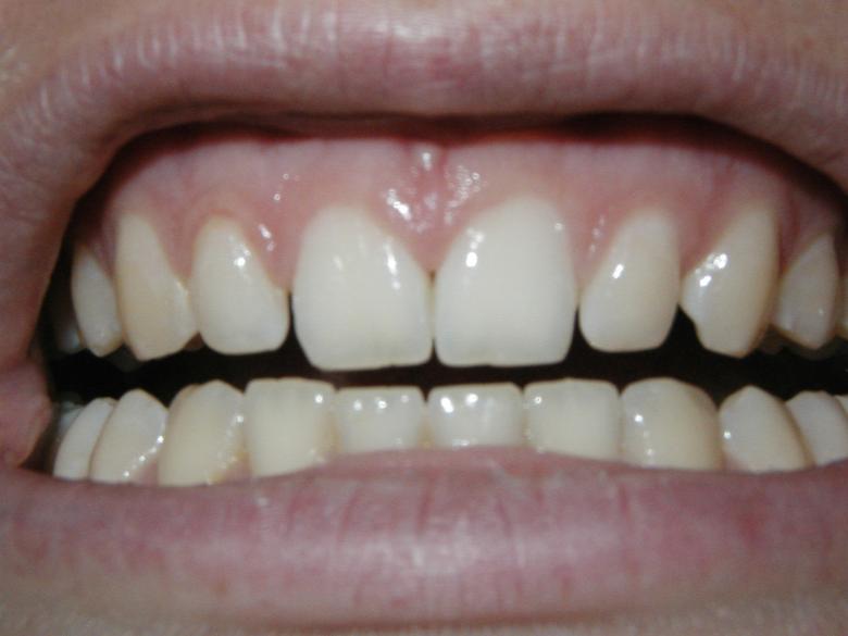 Free stock image of Teeth created by Bjorgvin