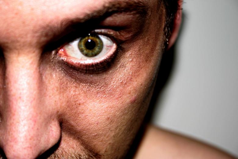 Free stock image of Eye created by Bjorgvin