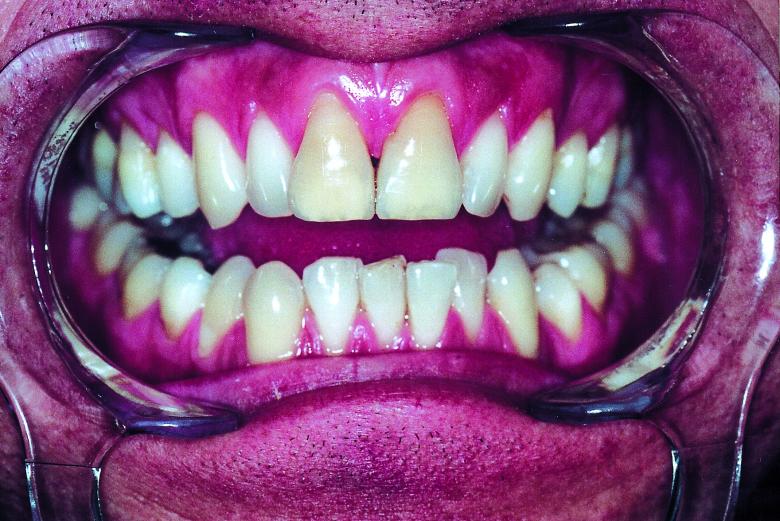 Free stock image of Teeth created by Bjorgvin