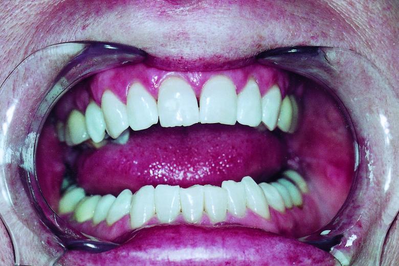 Free stock image of Teeth created by Bjorgvin