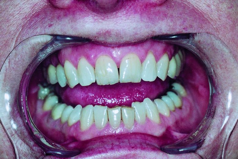 Free stock image of Teeth created by Bjorgvin