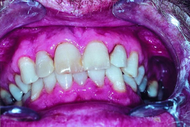 Free stock image of Teeth created by Bjorgvin