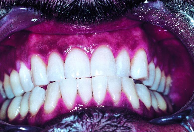 Free stock image of Teeth created by Bjorgvin