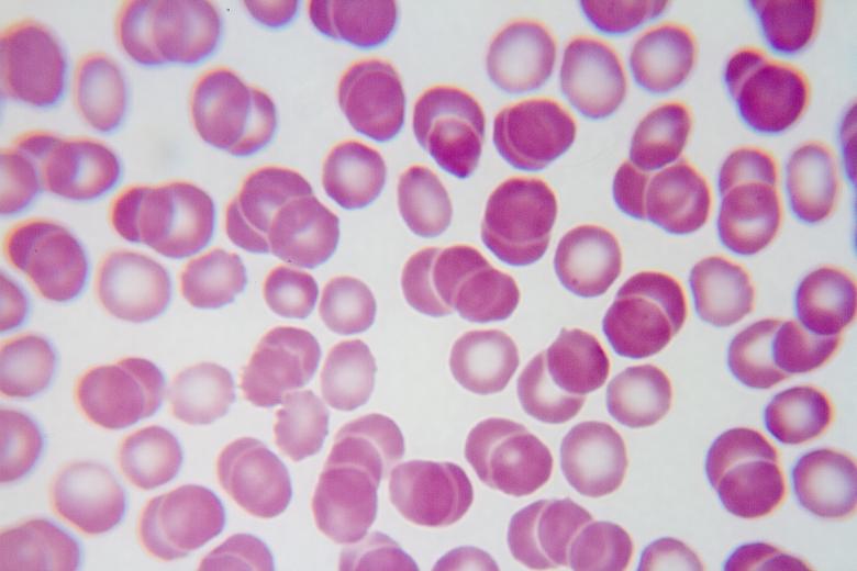 Free stock image of Red Blood Cells created by Geoffrey Whiteway