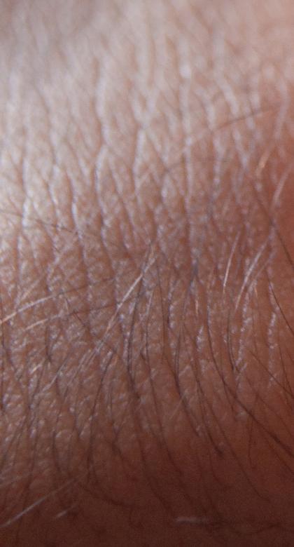 Free stock image of Skin created by Adnan Syed