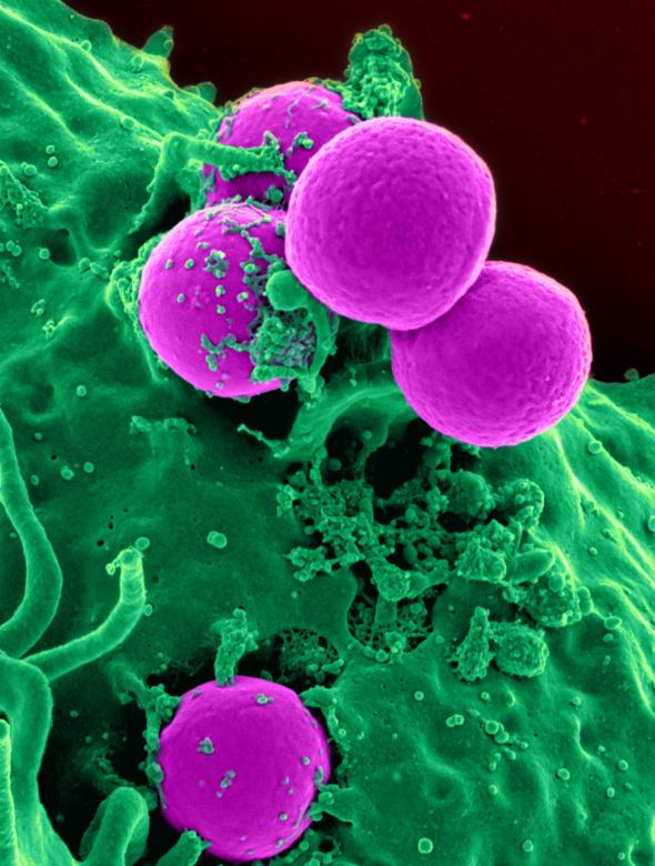 Free stock image of White Blood Cells created by Pixabay
