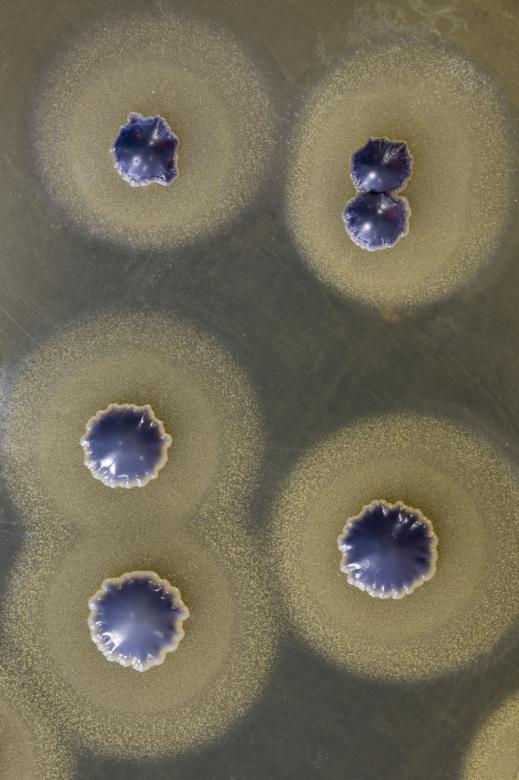 Free stock image of Staphylococcus aureus growing on agar created by Geoffrey Whiteway