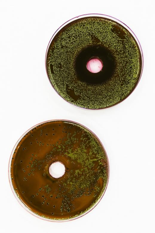 Free stock image of Bacteria growing on EMB agar created by Geoffrey Whiteway