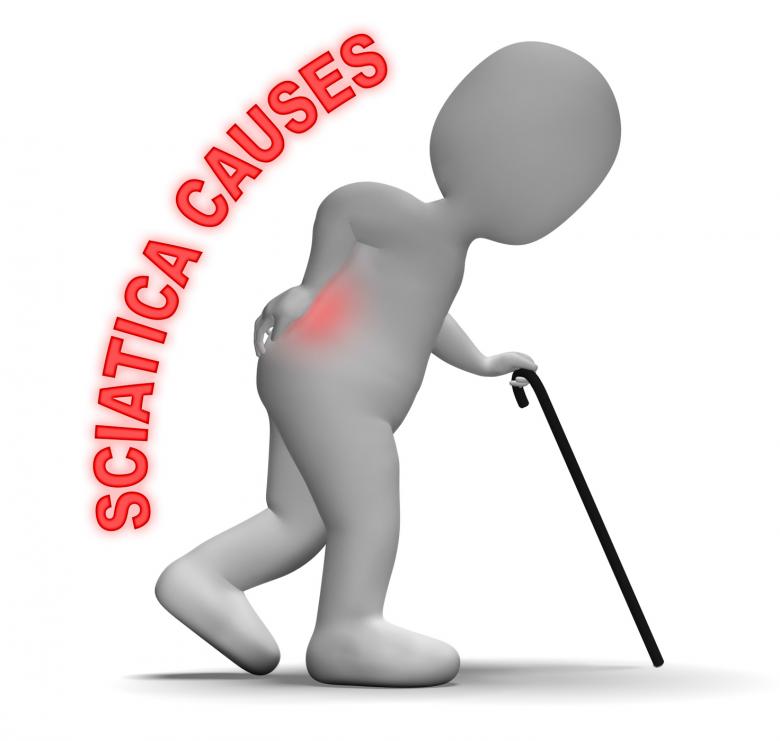 Free stock image of Sciatica Causes Indicates Vertebral Column And Back 3d Rendering created by Stuart Miles