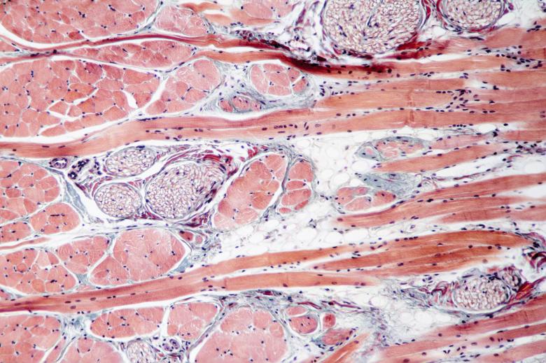 Free stock image of Muscle tissue created by Geoffrey Whiteway