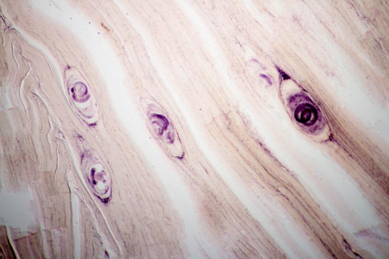 Free stock image of Trichinosis Texture created by Geoffrey Whiteway
