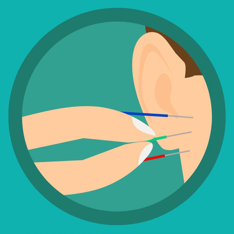 Free stock image of Acupuncture Ear Needles created by mohamed hassan