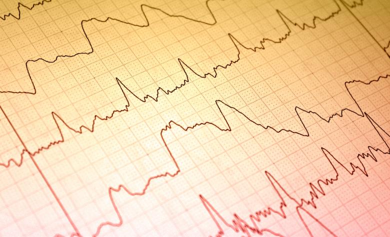 Free stock image of Rheoencephalography Metod created by NomeVizualizzato
