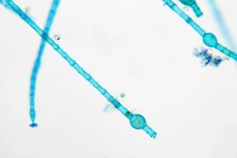Free stock image of Oedogonium created by Geoffrey Whiteway